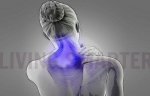 Fibromyalgia Neck Pain