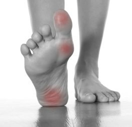 Otro de los puntos gatillo de la fibromialgia que puede agravar el cuerpo fibro a primera hora de la mañana es de alrededor de la fascia en la planta de los pies.