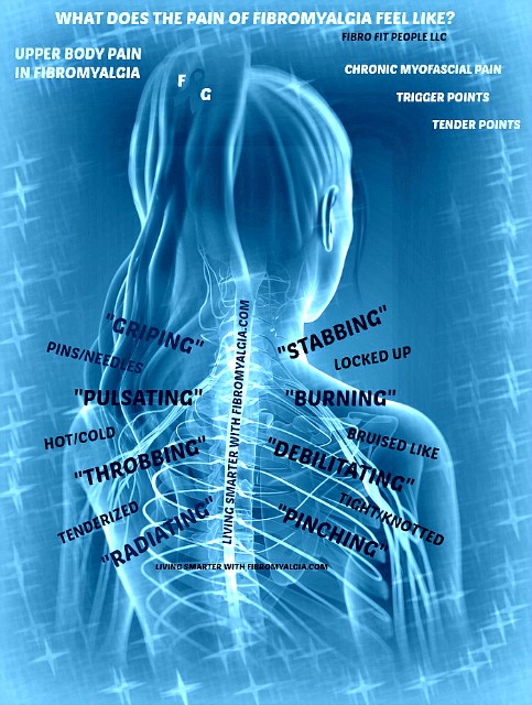 descripción del dolor fibroideo de la parte superior de la espalda