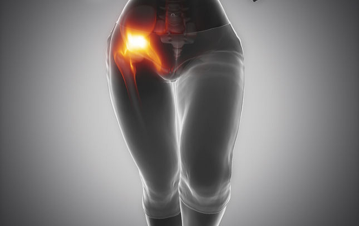 Fibromyalgia and Hip Flexor Pain 