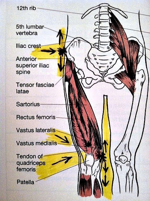 Fibromyalgia Lower Body Pain