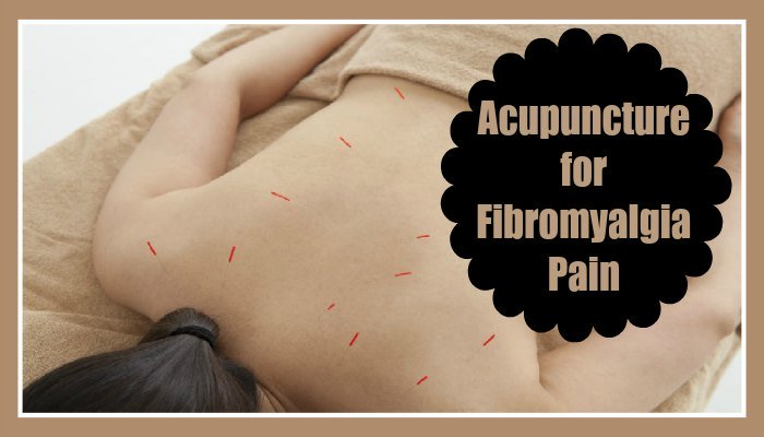 Acupuncture for Fibromyalgia Pain
