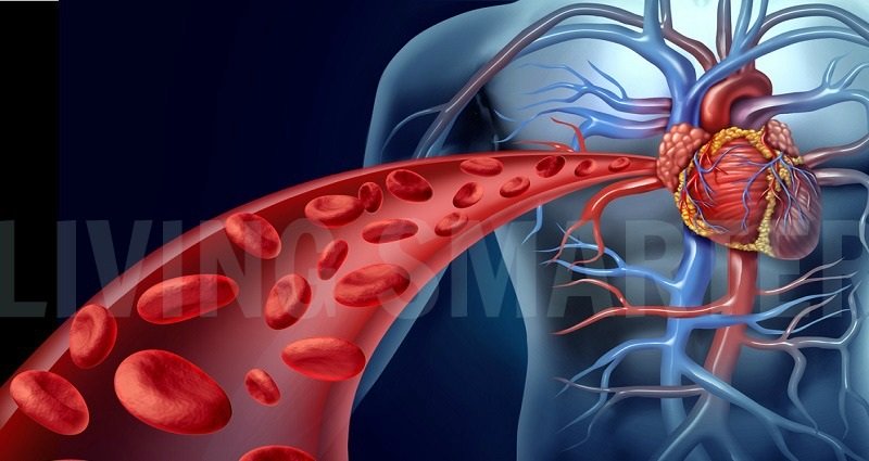 Fibromyalgia and Blood Vessels  – Is There a Connection?